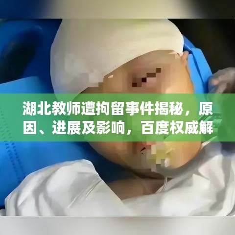 湖北教師遭拘留事件揭秘，原因、進展及影響，百度權(quán)威解讀！
