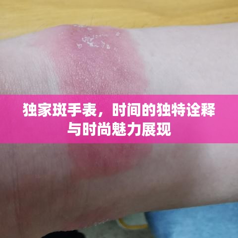 獨(dú)家斑手表，時(shí)間的獨(dú)特詮釋與時(shí)尚魅力展現(xiàn)